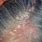 Skin Lesions On Scalp