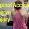 Spinal Accessory Nerve Injury