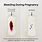 What Does Pregnancy Bleeding Look Like