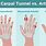 Wrist and Thumb Joint Pain