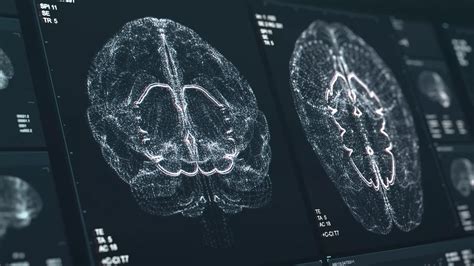 Frontiers in Neuroinformatics | Articles