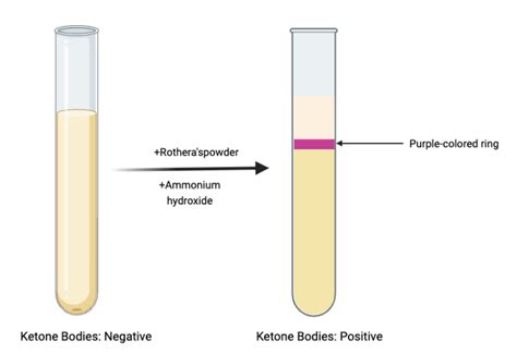 Rothera's test - Principle, Procedure, Result - Biology Notes Online