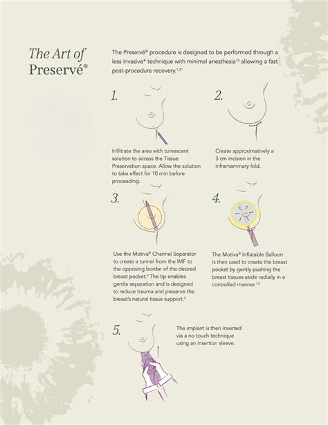 Preservé Technique Video - Jacob Bloom, MD