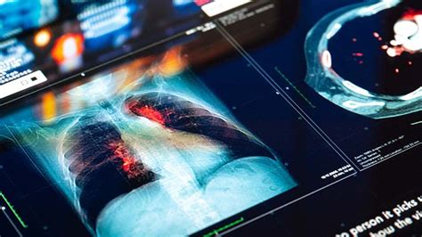 Clinical Programs - Inflo Health