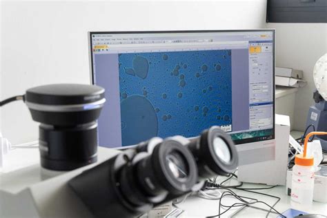 Comprendre les facteurs de virulence de la cryptococcose : étude par ...