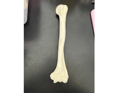 Anterior view- Humerus — Printable Worksheet