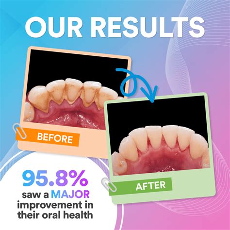 HydraPulse Wireless 5-In-1 Water Flosser Pro For Oral Care – petprovac