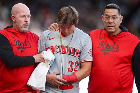 Reds’ Tyler Callihan suffers a forearm fracture
