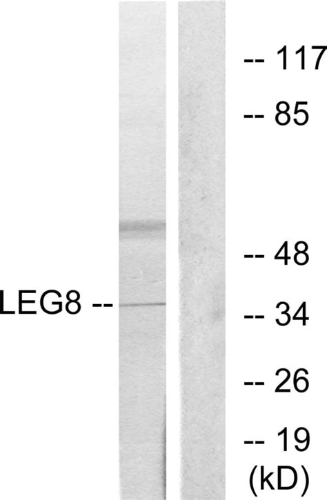 Anti-Galectin 8 Rabbit Polyclonal Antibody | VWR, part of Avantor