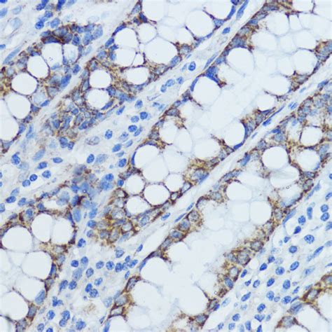 Aromatase Rabbit Polyclonal Antibody - SAB | Signalway Antibody
