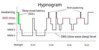 Dreaming While We're Awake | Psychology Today