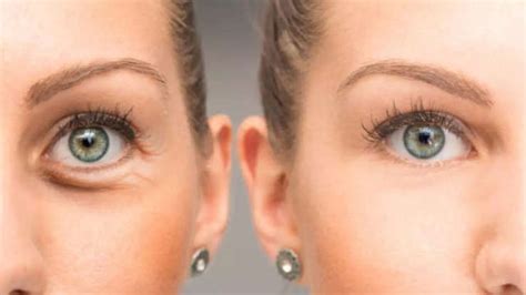 9 warning signs that eyes reveal about health