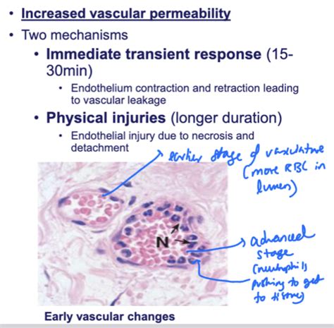 Lecture 29 - Inflammation Flashcards | Quizlet