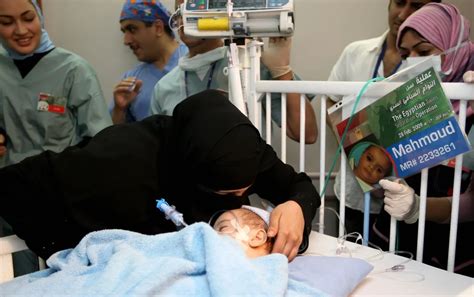 Saudi surgeons achieve rare separation of Filipino conjoined twins