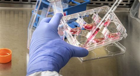 Supernus Shares Jump After Revenue Beat, Higher Guidance and Indivior ...
