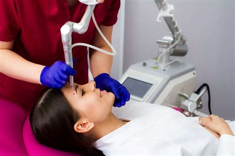 How Much to Remove Moles Without Hurting Yourself ⋆ ctf.bnsf.com