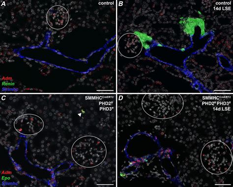 The endocrine product of renal (preglomerular) contractile pericytes ...