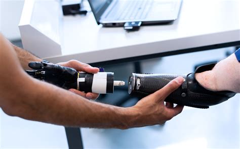 Prosthetics and Orthotics Reimagined: How Technology and Trauma Are Reshaping a $4 Billion ...