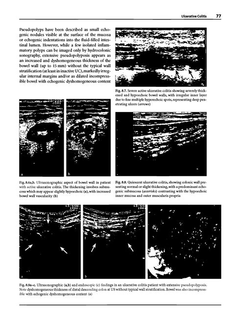 Muscularis propria - Big Chemical Encyclopedia