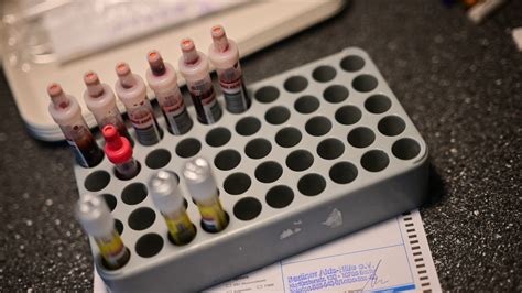 Darum gibt es in Trier so viele Fälle von Syphilis - SWR Aktuell