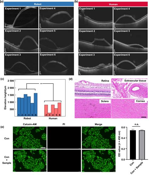 Ophthalmic surgical robot for precise retinal puncture and drug delivery - IOPscience