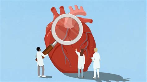 What to know about atrial fibrillation