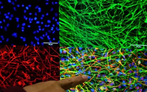Astrocytes found to form brain-wide, rewiring communication networks