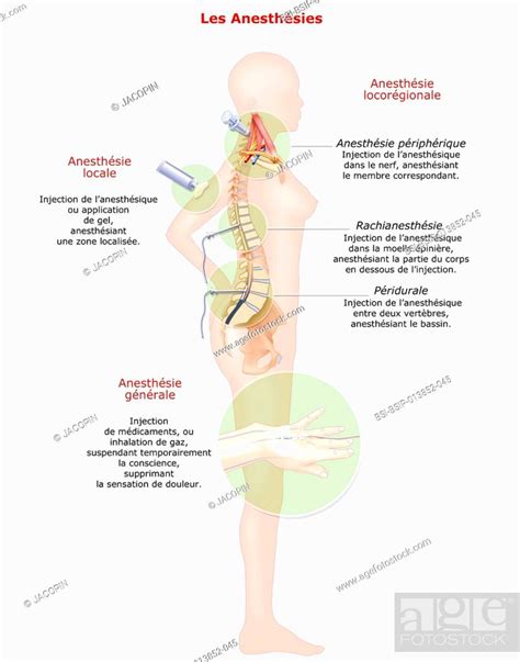 Anesthetics 的图像结果
