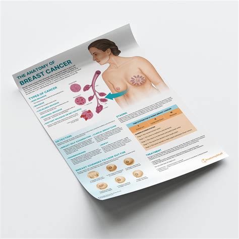 The Anatomy Of Breast Cancer Chart | Breast Cancer Awareness Chart | AnatomyStuff