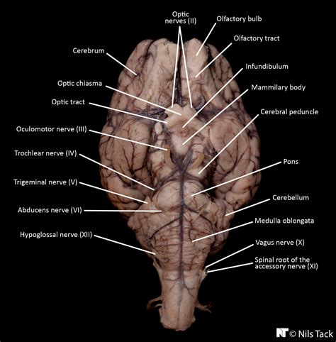 Labelled Sheep Brain