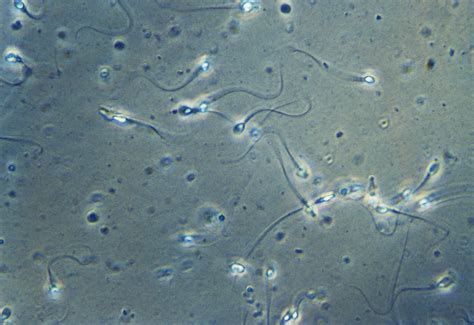 What Does Sperm Motility Mean?