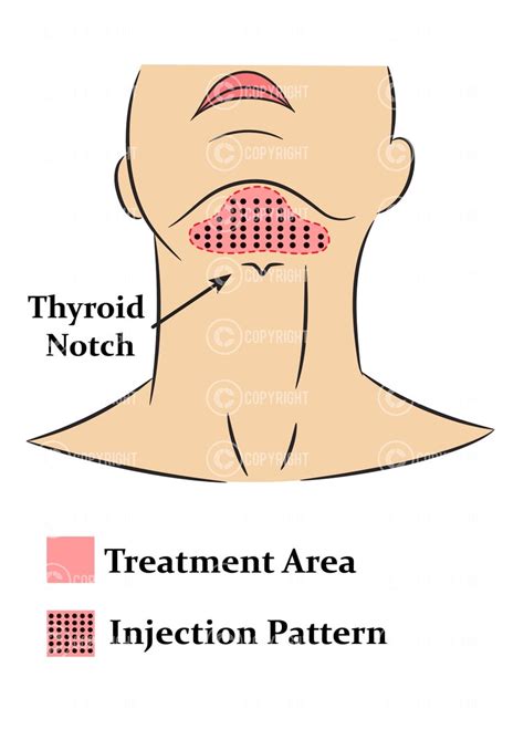 Image result for Injectable Pattern