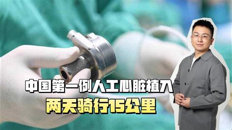 中国第一例人工心脏植入！移植人工心脏能活多久？要花多少钱？