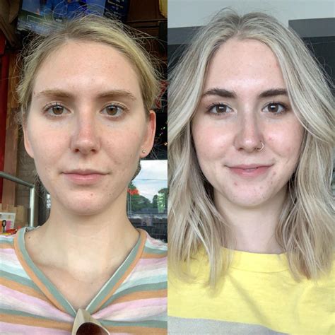 Facial Hair Bleach Before And After at Elmer Holt blog