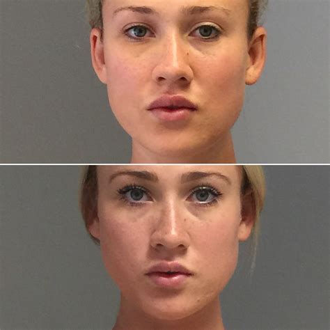 Medical Spa West LA & La Cañada Flintridge | Skin Specifics | facial reshaping 8293