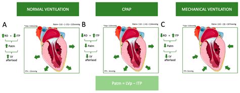 Navigating Heart-Lung Interactions in Mechanical Ventilation ...