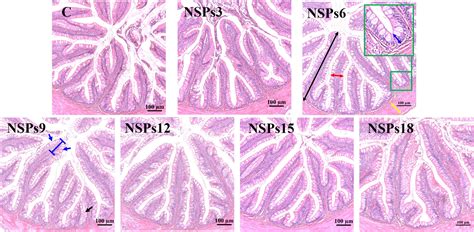 Frontiers | High dietary non-starch polysaccharides detrimental to ...