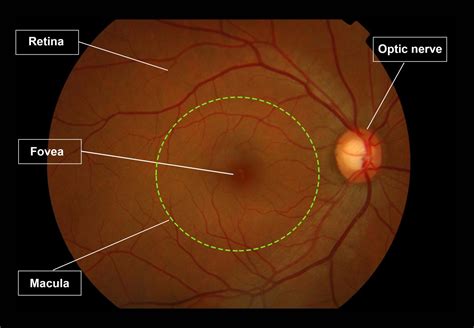 Retina - Gene Vision