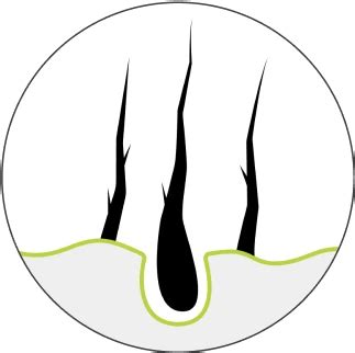 Get Free Hair Test Online – Personalized Hair Diagnosis – Traya