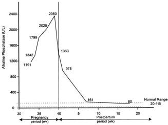 Isolated elevation of serum alkaline phosphatase level in an ...