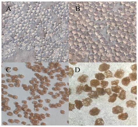 Encapsulation and Characterization of Proanthocyanidin Microcapsules by ...