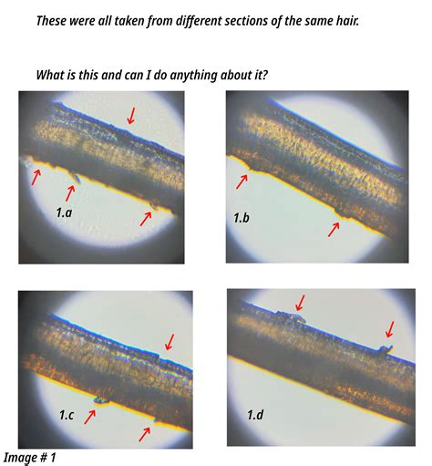 Unwashed Hair Under Microscope Microscopic Hair Hi Res Stock