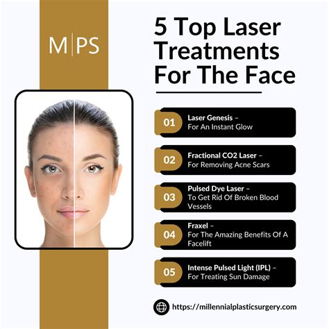 Face Laser Treatment Cost at Kristina Hertz blog