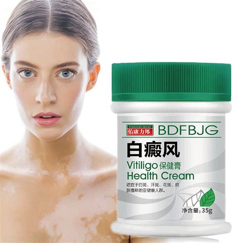 Vitiligo Cream Vitiligo Care Cream Vitiligo Treatment For Skin Vitiligo ...