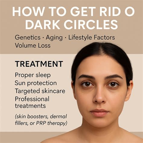 How to Get Rid of Dark Circles: Expert Treatment Guide