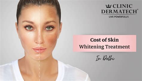 Face Laser Hair Removal Cost Delhi at Jai Reading blog