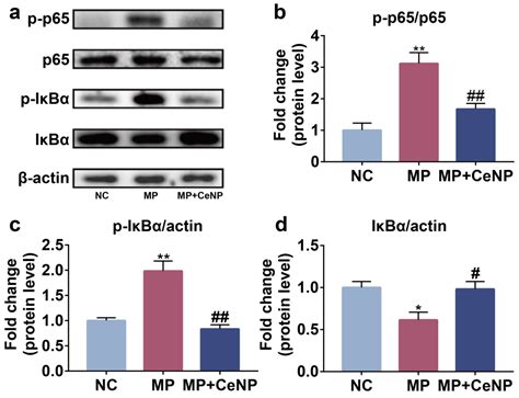 Ceria Nanoparticles Alleviated Osteoarthritis through Attenuating ...