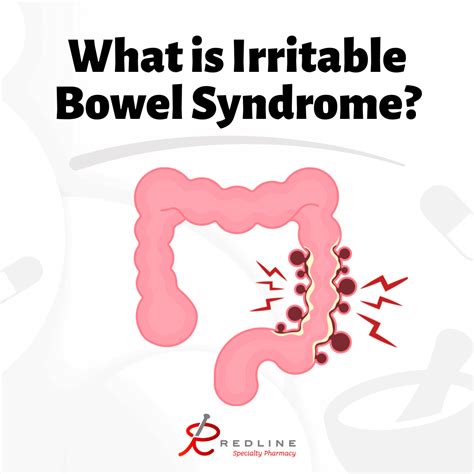 What is Irritable Bowel Syndrome (IBS)? - Redline Specialty Pharmacy