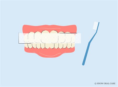How to Get Rid of Yellow Teeth After Braces: Try This Now! - SNOW® Oral ...