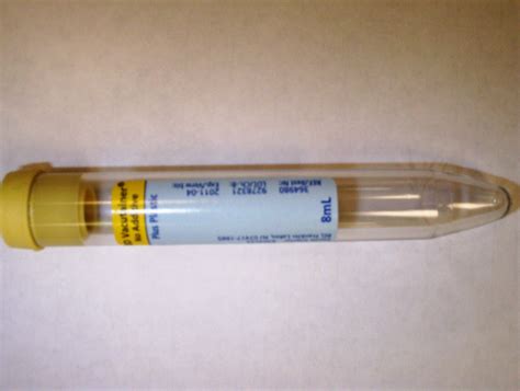 Gc/chlamydia Urine Test Tube Wholesale Stores | elevate.in